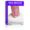Orly Nail Rescue Kit